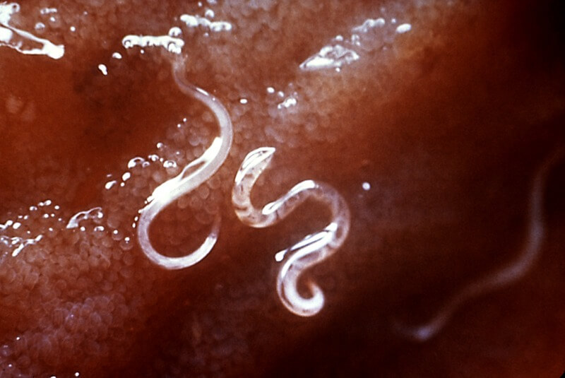 comparsa di anchilostomi nell'intestino