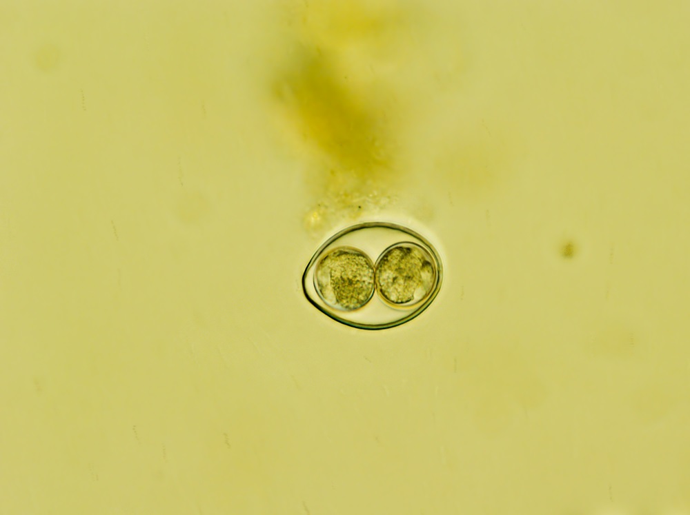 Aspetto microscopico del parassita Cystoisospora coccidia, che appare come un grande cerchio con due cerchi più piccoli al centro su uno sfondo giallo-verdastro.